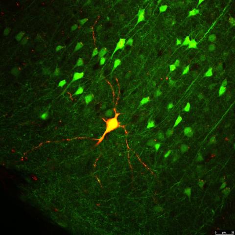 Neuron highlighted in brain