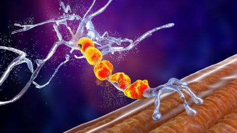 Motor neuron